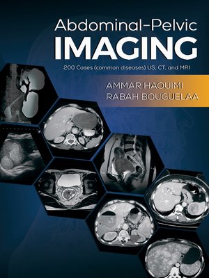 cover image of Abdominal-Pelvic Imaging